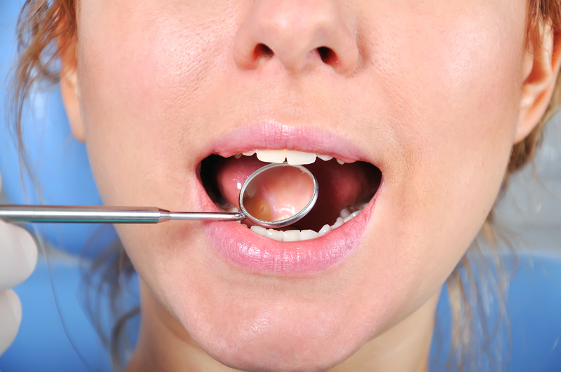 Dentalplus: Alle vier Weisheitszähne gleichzeitig ziehen?