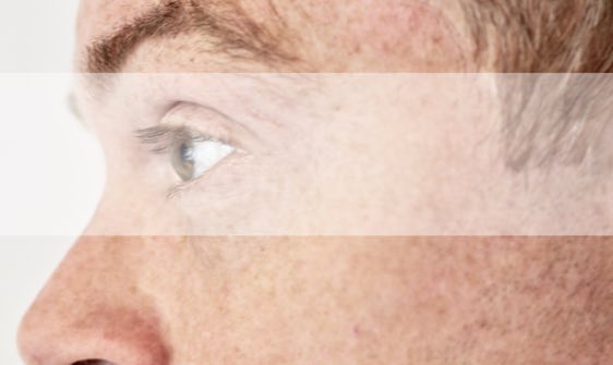 Augenarzt für Neuss informiert über neue Kassenleistung