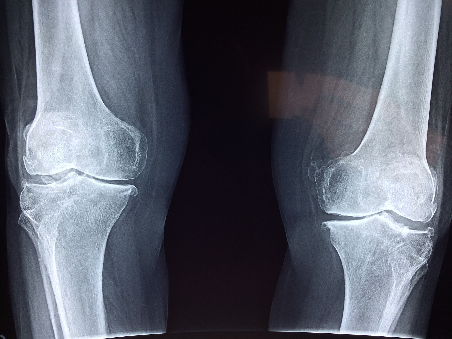 Internationaler Tag der Radiologie am 8. November: Röntgeninstitut Düsseldorf informiert über die Bedeutung der radiologischen Bildgebung