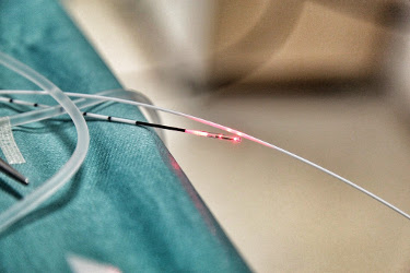 biolitec: Minimal-invasive Eingriffe mit Laser haben deutliche Vorteile bei Infektionsgefahren durch Viren