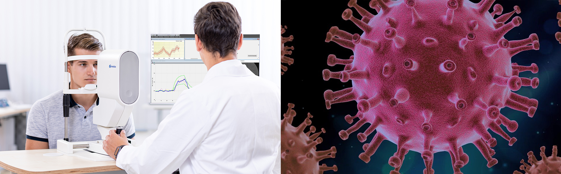 Imedos-Technologie der Dynamischen Gefäßanalyse: Endothelfunktion analysieren und mögliche Hochrisikopatienten für schwere COVID-19 Verläufe erkennen