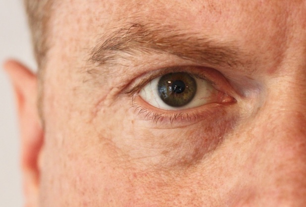 Symptome und Therapie bei Glaskörpertrübung