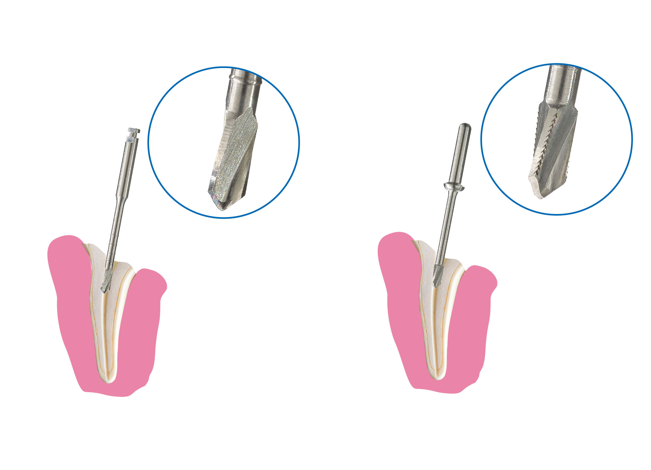 Abgebrochene Tierzähne:   Abgebrochene Zähne  bei Tieren