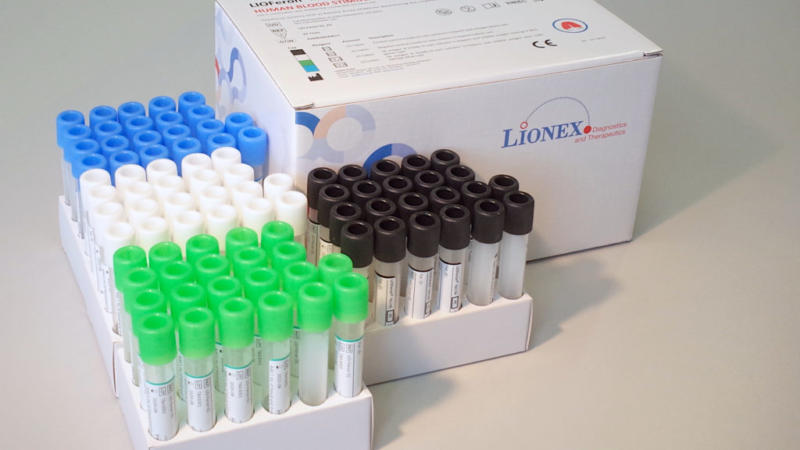 IGRA TB LIOFeron®, unique test,  excludes TB by M. bovis