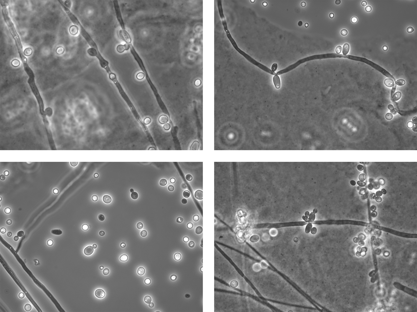 Wenn Candida nicht Candida ist – die Herausforderung der Benennung von Pilzen