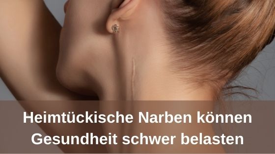 Heimtückische Narben können Gesundheit schwer belasten