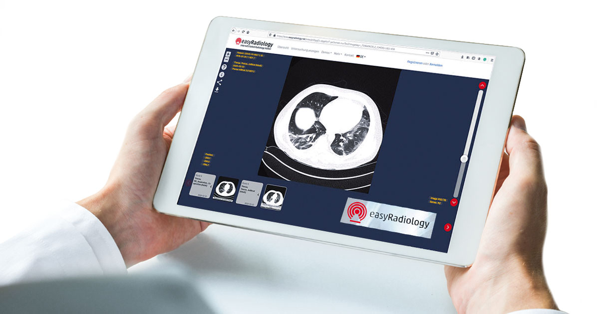 Radiologie nach der Pandemie: Zuweiserportale bleiben