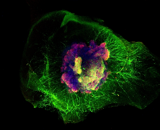 Jens Schwamborns 3D-Mini-Gehirne helfen im Kampf gegen das Corona-Virus