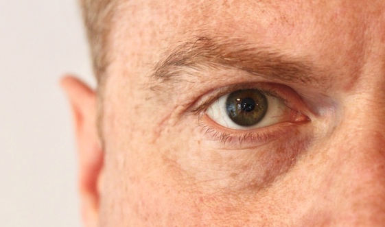 Augenarzt für Neuss: Laserbehandlung bei Makuladegeneration?