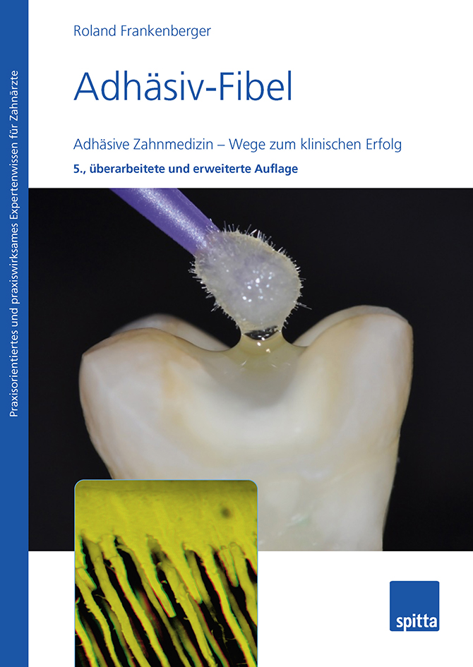 Umfassende Materialkunde mit dem neuen Werk „Adhäsiv-Fibel“