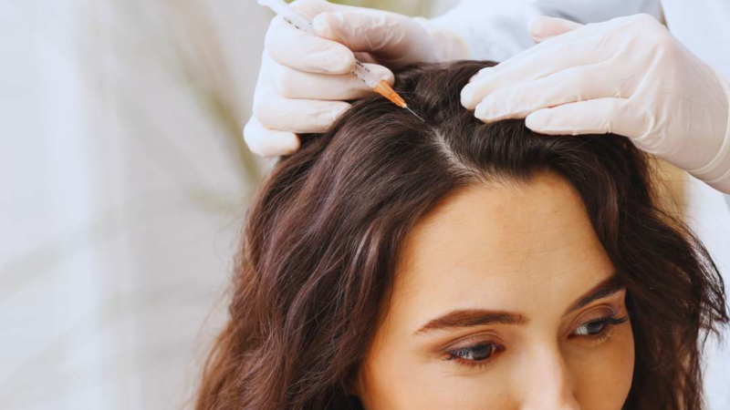 Haarausfall nach Corona-Erkrankung – Was hilft wirklich?