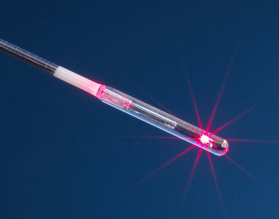 biolitec laser system LEONARDO DUAL performs very well with radial FiLaC laser fiber in Acne inversa and Sinus pilonidalis