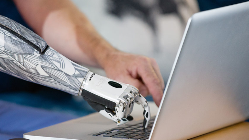 Neue Digitallandschaft bei Prothetik-Weltmarktführer Ottobock