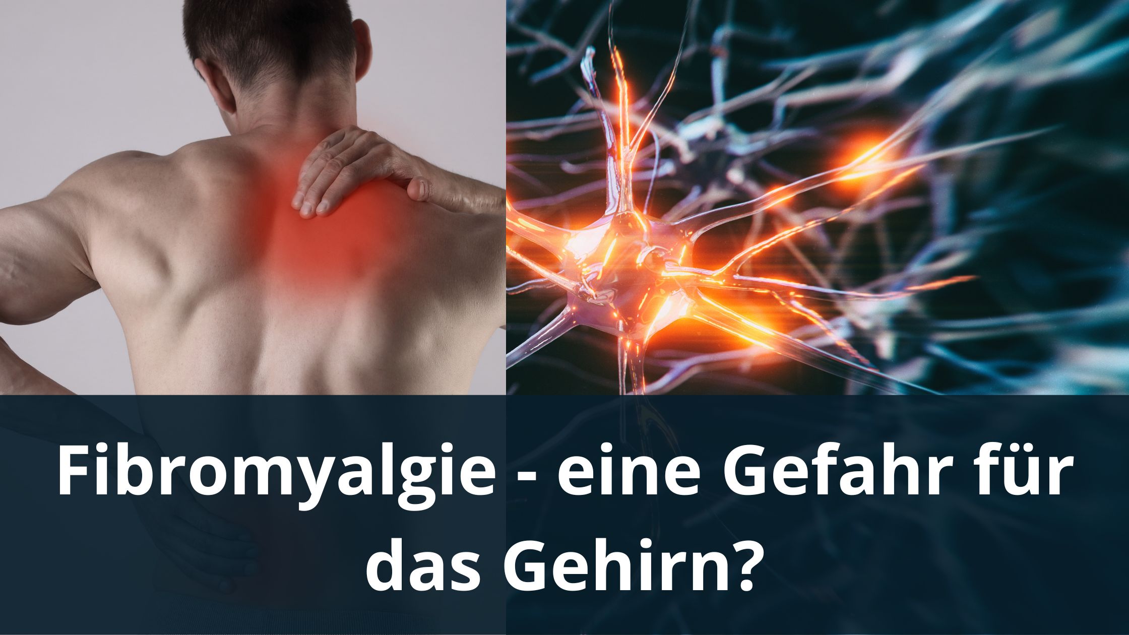 Fibromyalgie – eine Gefahr für das Gehirn?