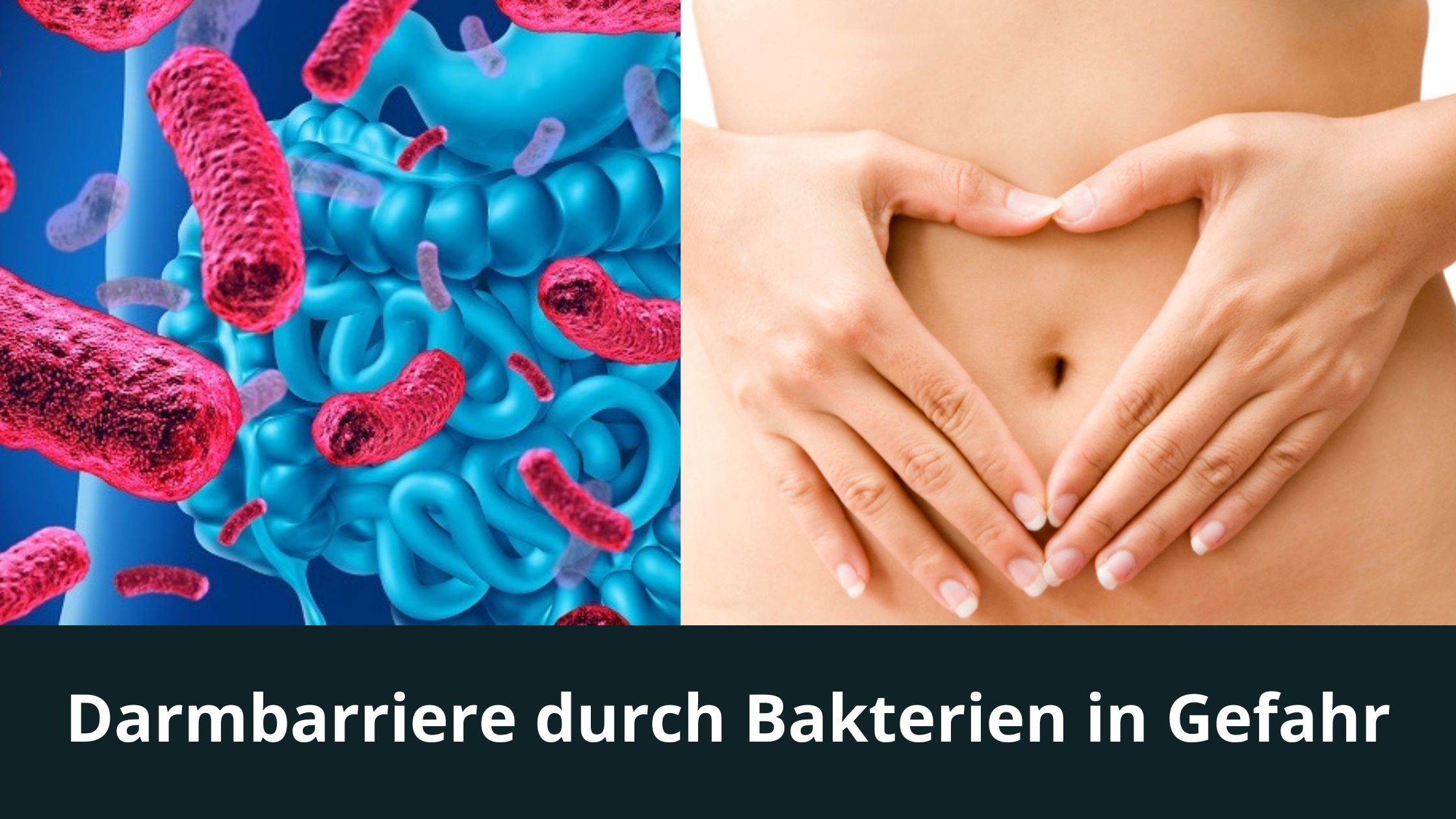 Darmbarriere durch Bakterien in Gefahr