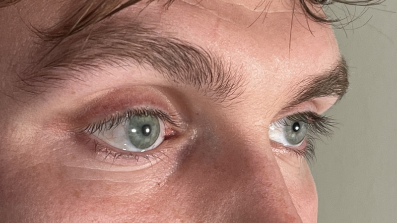 Durchbruch: Perfektes Computergenerierte Augenprothesen aus dem 3D-Drucker überzeugen in der Praxis