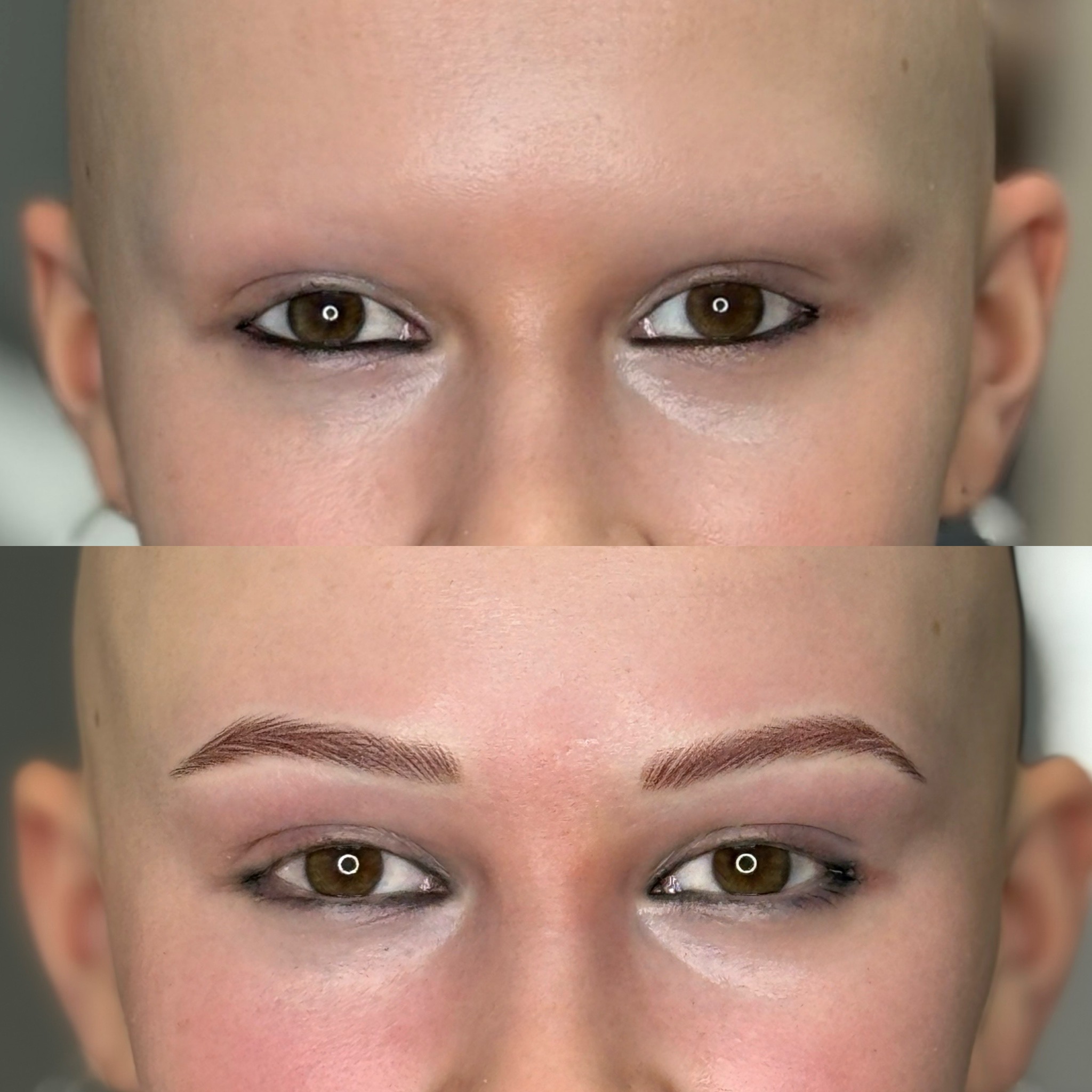 Hilfe bei Haarverlust durch Alopezie oder Chemotherapie