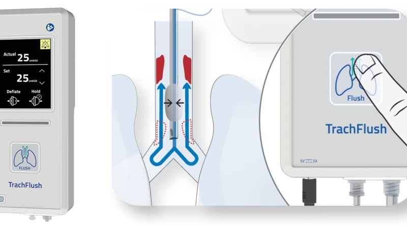 Asahi Kasei Medical und AW Technologies schließen exklusive Vertriebsvereinbarung für TrachFlush in Japan