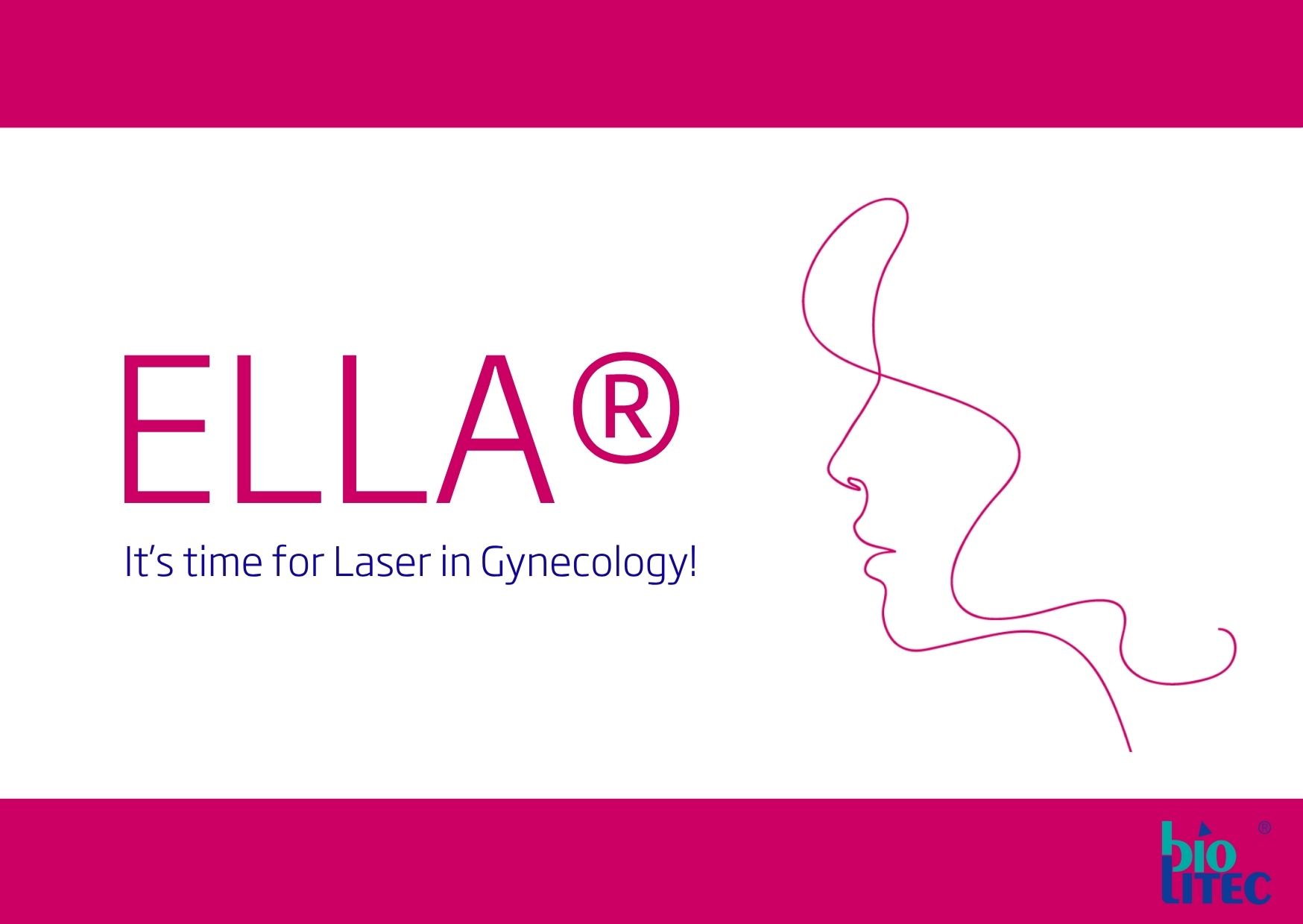 New Clinical Study Highlights Benefits of Dual Wavelength Diode Lasers in Treating Ovarian Endometrioma