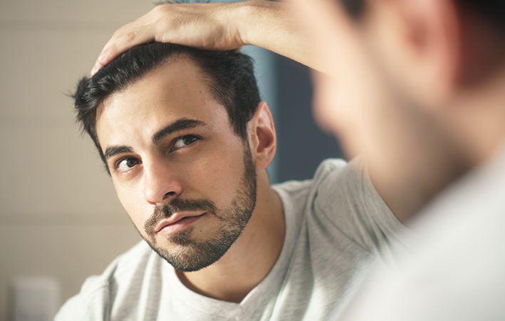 Haartransplantation nur in Ausnahmefällen absetzbar