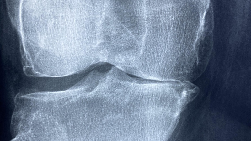 Orthopädie Berlin: Worauf Patientinnen und Patienten achten sollten