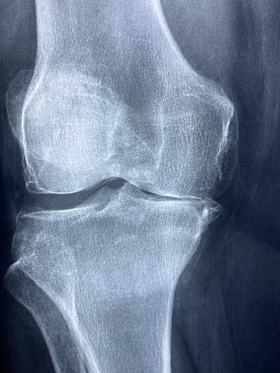 Orthopädie Berlin: Worauf Patientinnen und Patienten achten sollten